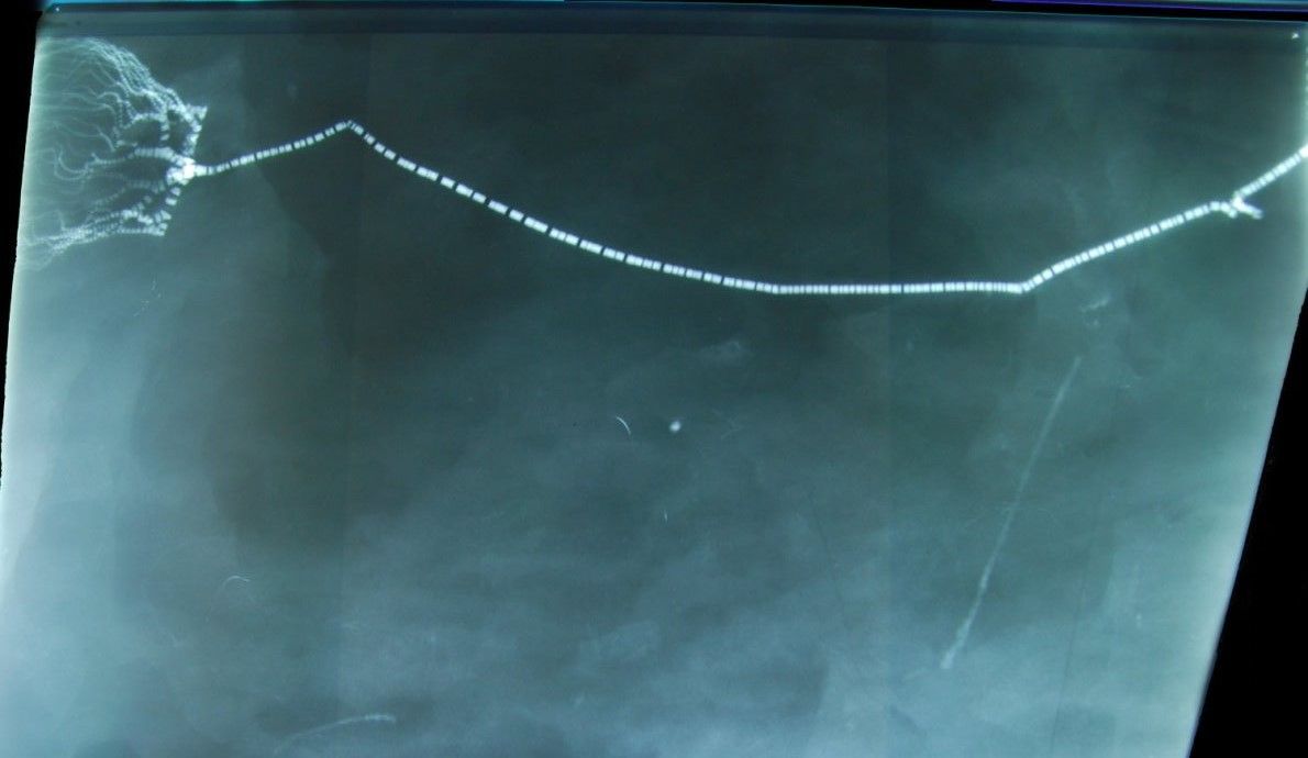 Bundenbach_Taxocrinus_xray