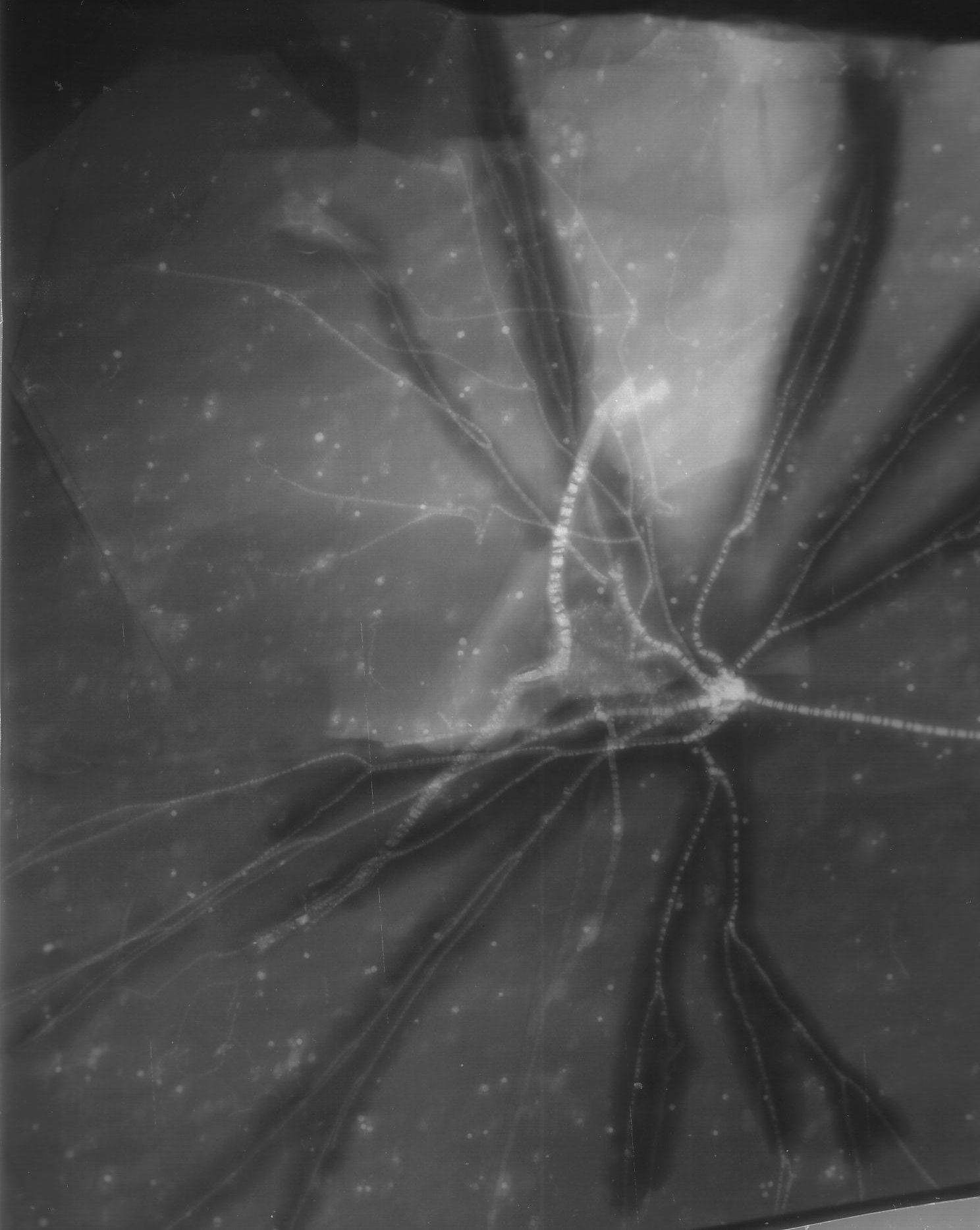 05_01_Follicrinus grabei; 29x29 cm; Bundenbach_X-ray