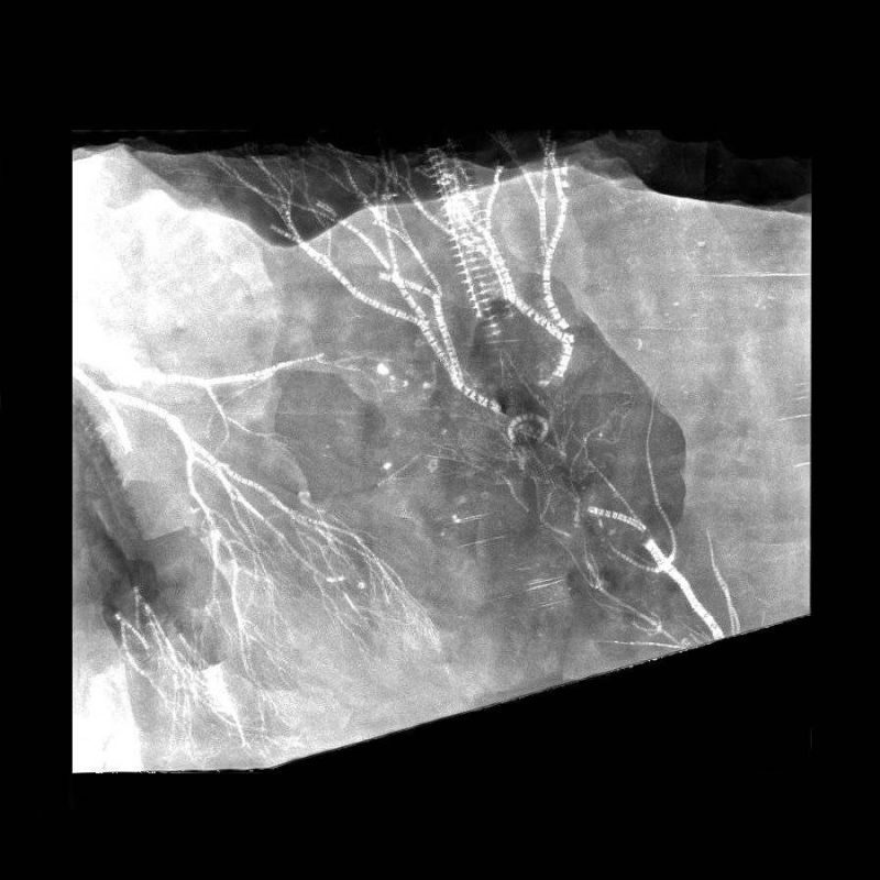 Gastrocrinus giganteus, Bundenbach