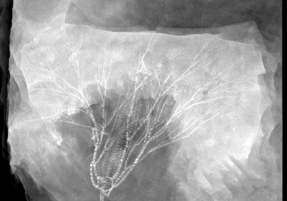 06_01_Gastrocrinus giganteus; 29x23 cm; Bundenbach_X-ray