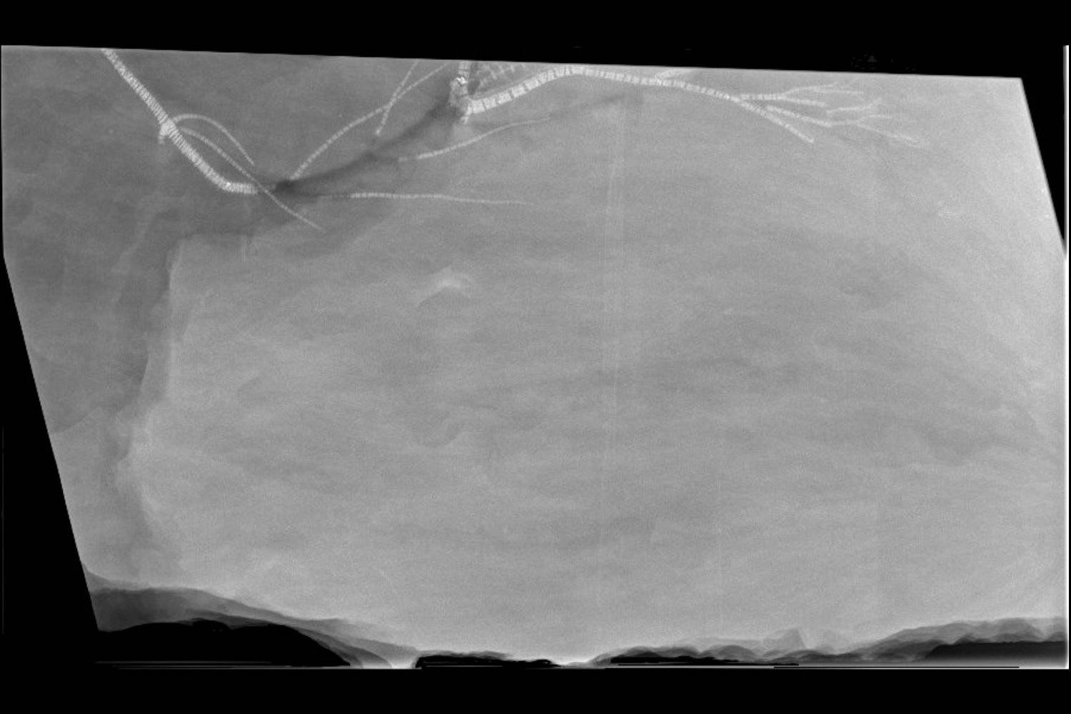 Gastrocrinus giganteus, Bundenbach