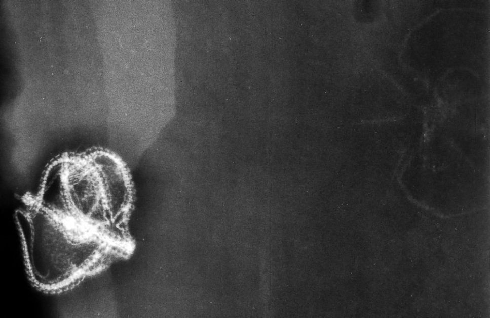 Mimetaster_Taeniaster_xray