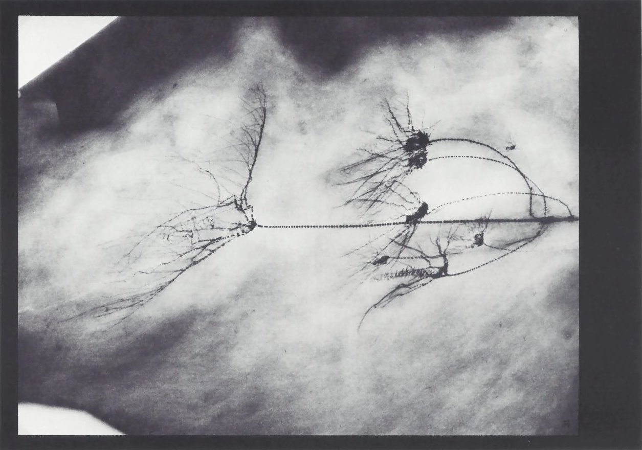 Bundenbach-Fossil_Tafel_13